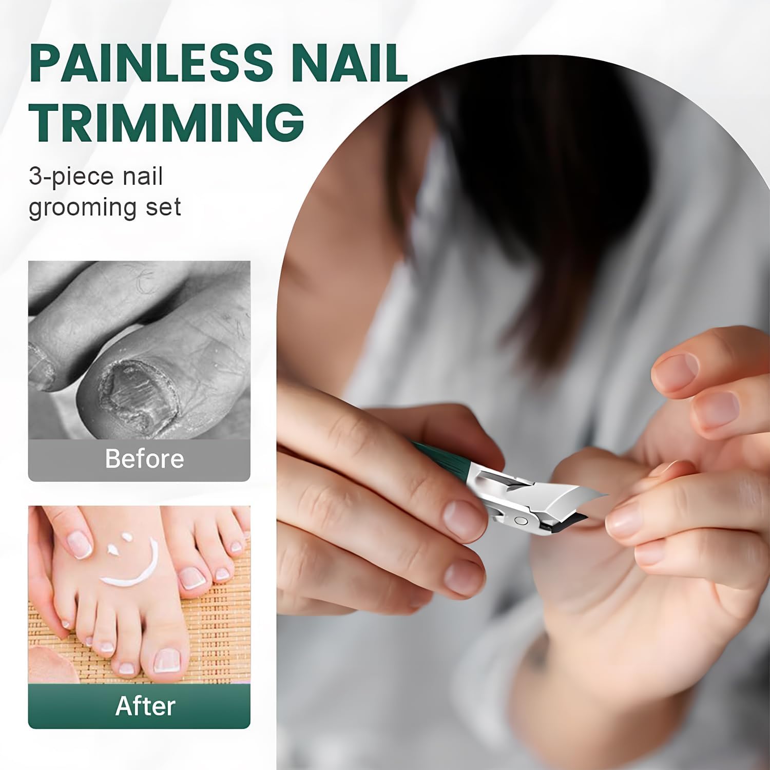 Ingrown Toenail Clipper – Sharp Wide-Opening Nail Trimmer for Thick & Hard Nails, Green